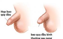 hep-bao-quy-dau-o-nam-gioi-can-biet